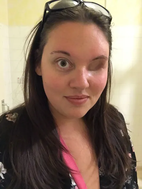 A Face Unhidden, A Story Told